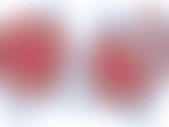 La neoplasia y su tratamiento