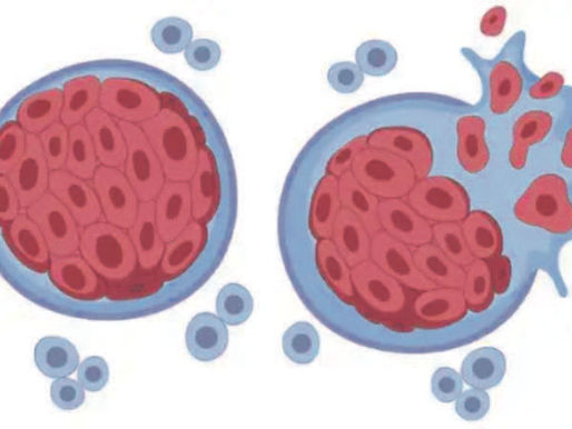 La neoplasia y su tratamiento