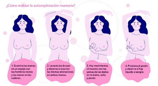 Síntomas y tratamientos del Cáncer de Seno