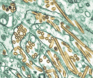 Possible cluster of human bird-flu infections expands in Missouri