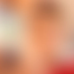 Oftalmólogos advierten de que el ojo vago es la principal causa de pérdida visual prevenible en niños