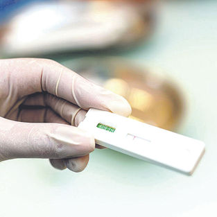 La autoprueba del VIH ahora es más rápida