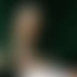 Woman receiving acupuncture for menopause and hot flash relief at Deanna Carell Aesthetics + Acupuncture