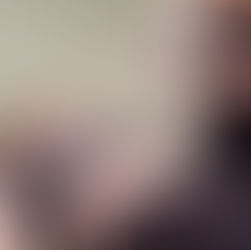 girl receiving moxibustion treatment