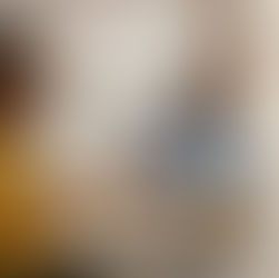 Acupuncture needles gently placed on the abdomen to improve digestion and restore gut balance