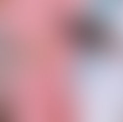 Woman receiving acupuncture for cancer treatment side effects to help reduce joint pain and improve comfort.