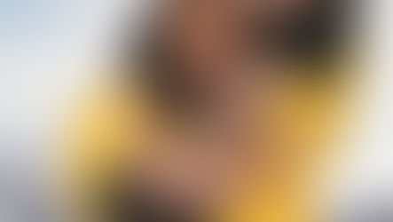 Acupuncturist placing fine needles along the wrist and forearm to relieve carpal tunnel pain and improve nerve function at Deanna Carell Aesthetics + Acupuncture