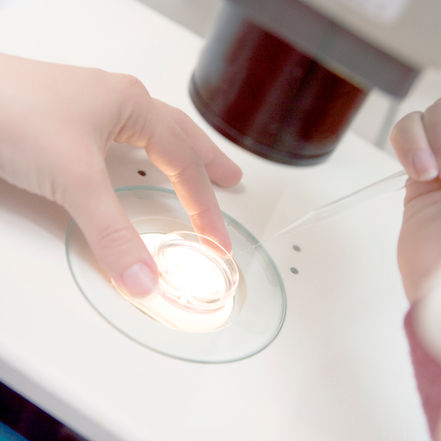 A férfi meddőség – Mit jelent a spermaanalízis, és mit tehet az andrológus?