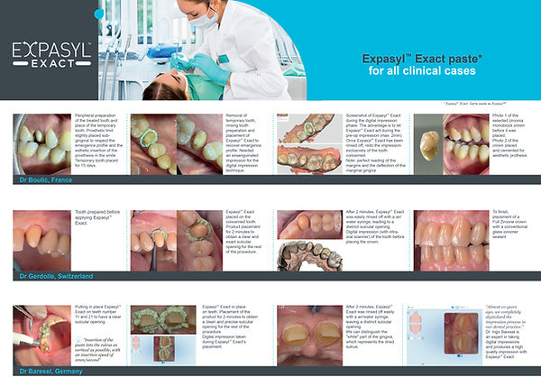 Acteon Expasyl Exact Paste