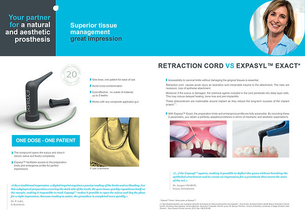 Retraction Cord VS Expasyl Exact