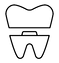Invisalign in Luton