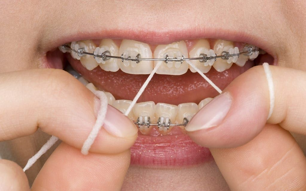 flossing with braces