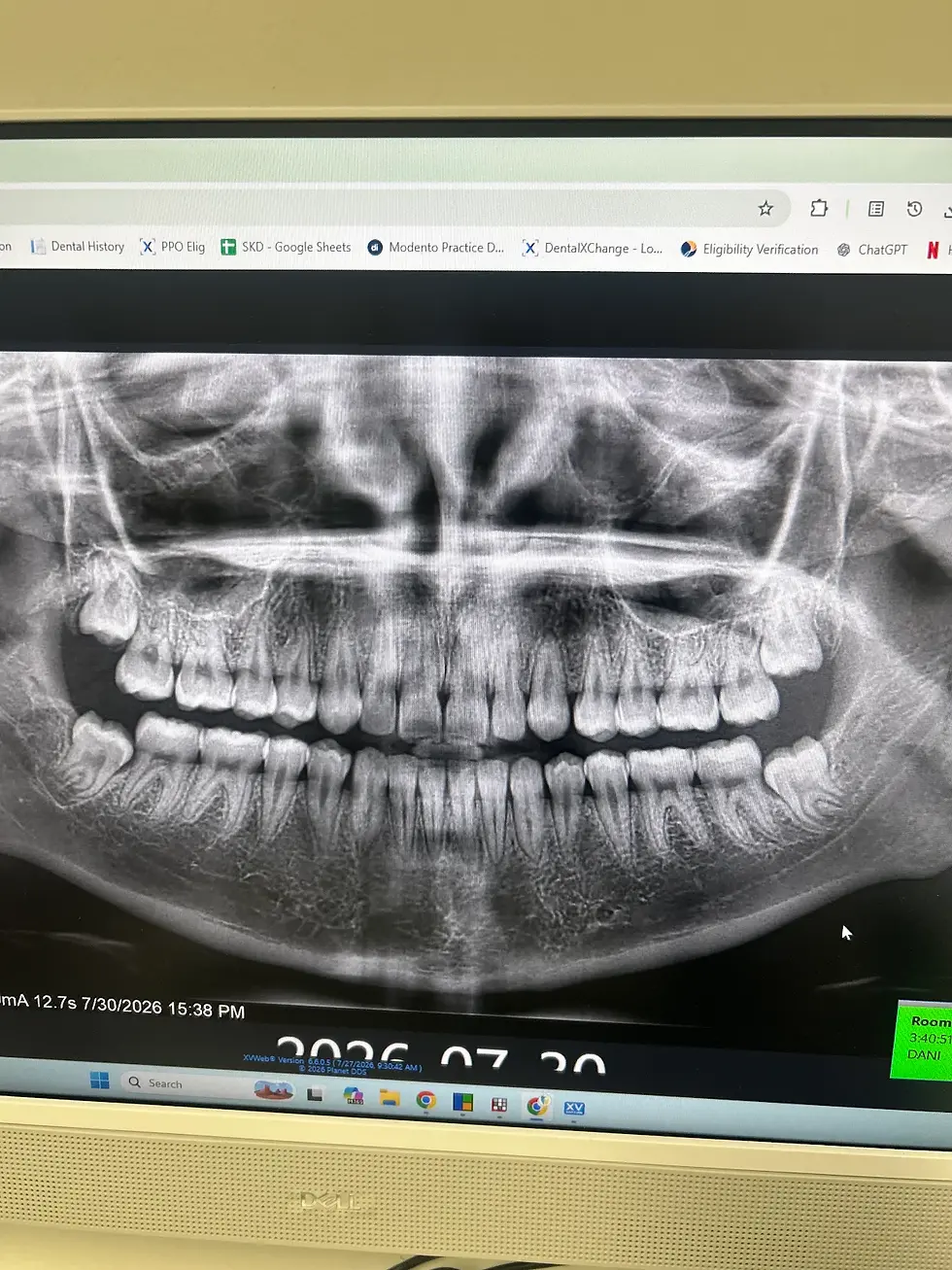 Dental panoramic X-ray on a computer screen showing full upper and lower teeth, with impacted wisdom teeth and browser tabs.