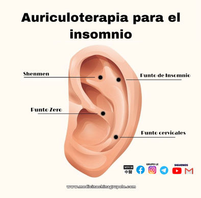 Insomnio con Auriculoterapia