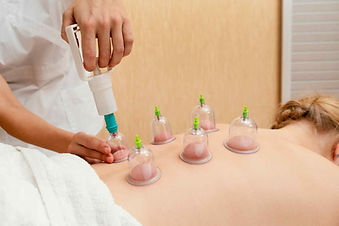 68a85dff50ede91ee6a45c10_2Cupping.jpg