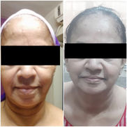 Anti Aging Treatment.jpg