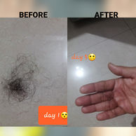 HAIRFALL 2.jpg