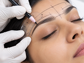 Eyebrow Transplant