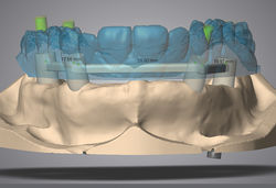 4_SRBB_Waxup_2015-08-06