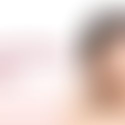 แนะนำฉีดฟิลเลอร์หน้าผากยี่ห้อไหนดี?