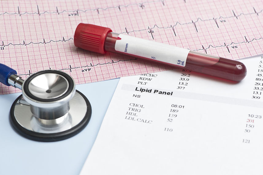 Weight loss diabetes and heart health dietitian Perth Nutrition Nation