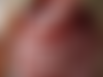 Key Symptoms and Signs of Stomach Cancer