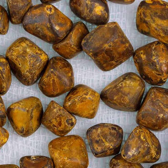 Effective Strategies for Gallstones Management and Prevention