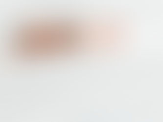 The Importance of Having an Expert When Undertaking a Voluntary Disclosure Program (VDP)