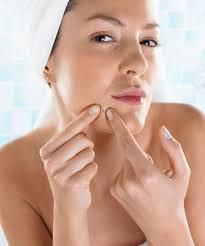 obsessive pimple popping