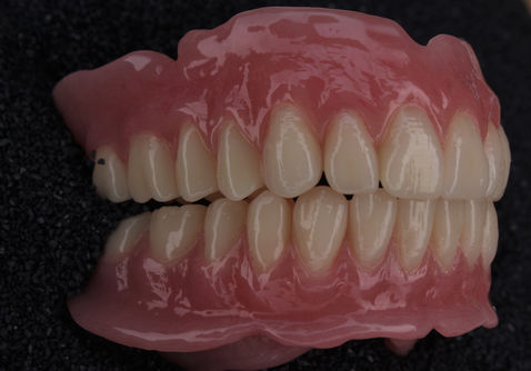 dentures close up