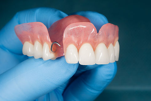 partial dentures