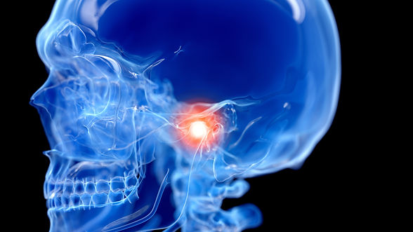 3d illustration of TMJ