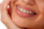 smiling woman with braces