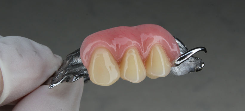 dentures close up