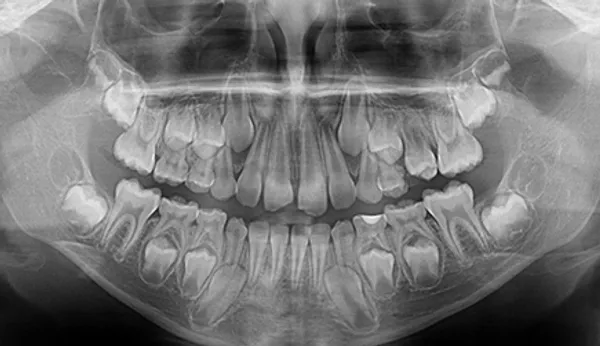 2d Goruntuleme Turkiye Denttom Dental Goruntuleme