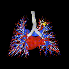Infervision Türkiye
