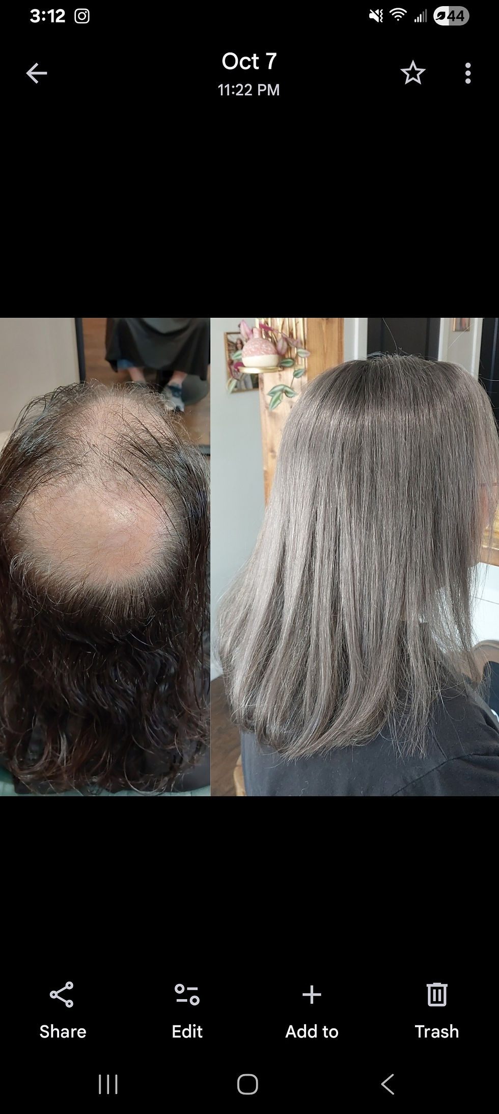 before and after