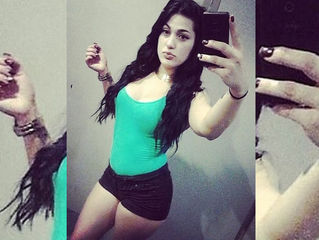 Quiso mejorar sus nalgas , se opero y murió