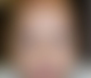 When Is the Right Time for Orthognathic Surgery After Palate Repair?