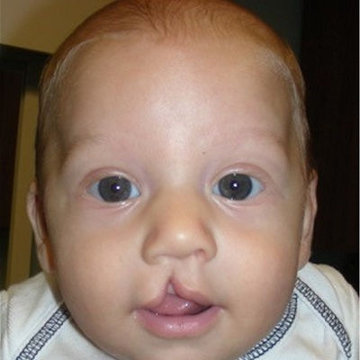 افضل جراحة إصلاح الحنك في مسقط