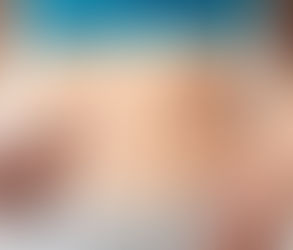 How Long Will Swelling Last After Lipomatic?