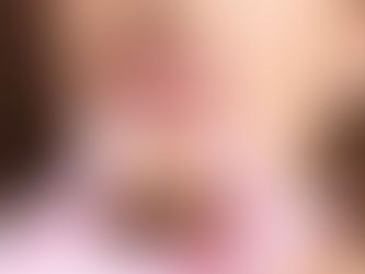 Jawline Filler Injections: Everything You Need to Know for a Defined Look