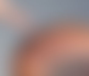 زراعة الشعر لمرضى العلاج الكيميائي: هل هي ممكنة؟