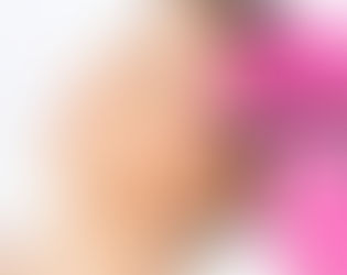 كيفية مقارنة حقن الهياليفت بمعززات البشرة