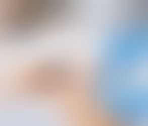 Body Fillers for Hip Enhancements: Achieving Feminine Curves