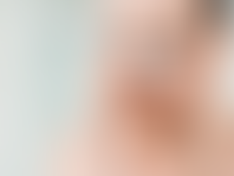 Rhinoplasty Complications: Understanding and Managing Risks