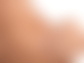 Keloid Scar Treatment Costs: An In-Depth Guide