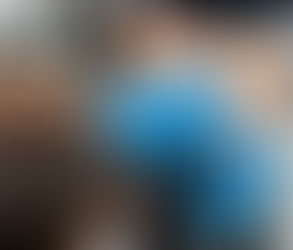 تطور حقن إذابة الدهون: تقنيات واتجاهات جديدة