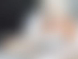 Top Benefits of Laser Skin Tightening for Youthful Skin In Dubai