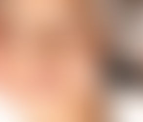 علاج الوجه باستخدام أوكسيجينيو: سر الحصول على بشرة متوهجة